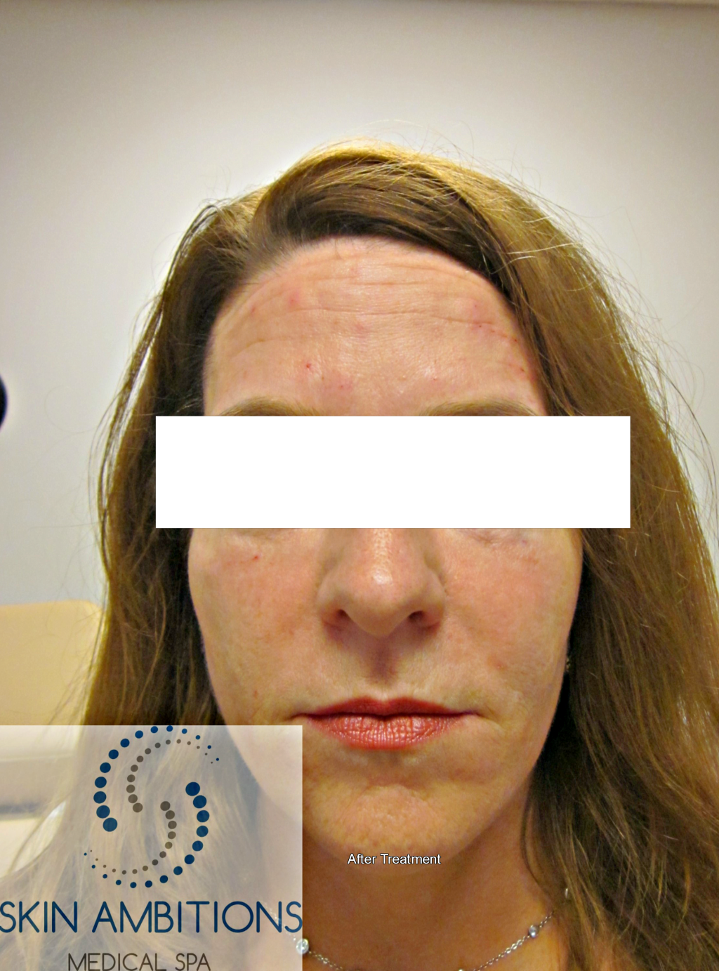 Facial Contouring Skin Ambitions
